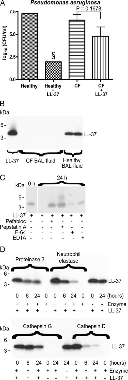 FIGURE 3. Antimicrobial activity of exogenous LL-37 is inactivated by cathepsin D and neutrophil elastase in CF BAL fluid. A, Anti-Pseudomonal effect of 32 μM LL-37 after 24 h incubation in BAL fluid from healthy controls (n = 4) and CF individuals (n = 6). B, Western-blot analyses of synthetic LL-37 after 24 h incubation in CF and control BAL fluid. C, Inhibition of proteolytic degradation of LL-37 after 24 h incubation by specific protease inhibitors pefabloc and pepstatin A but not by E-64 and EDTA. D, Incubation of synthetic LL-37 with the serine proteases proteinase 3, neutrophil elastase and cathepsin G and the acidic protease cathepsin D from 0 to 24 h. §, No viable bacteria remained in 100 μl of 10-fold diluted sample. SEM is indicated by the bars and two-tailed p value calculated by unpaired t test. Each experiment was performed at least three times.