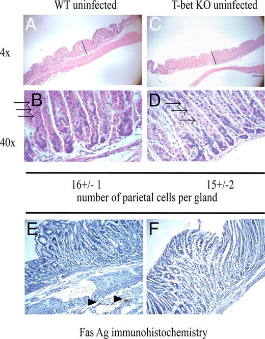 FIGURE 1. Histology of uninfected WT and T-bet mice are similar. H&E staining of WT C57BL/6 mouse (A, ×4; B, ×40) and T-bet KO mouse (C, ×4; D, ×40). Parietal cells (arrows) are large cells with pale pink cytoplasm and centrally located nuclei. Chief cells stain deeper purple and are seen at the gland base. Architecture is unchanged between the WT and T-bet KO mouse. Bar, 600 μm. Fas Ag immunohistochemistry in (E) WT mouse and (F) T-bet KO mouse. Arrow, positive staining inflammatory cells in connective tissue.