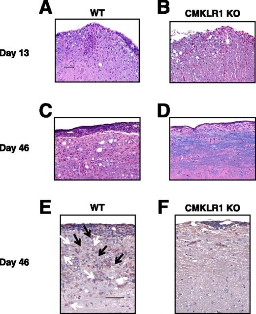 FIGURE 2. Reduced histological EAE in CMKLR1 KO mice. Representative spinal cord sections are shown from actively immunized WT (left panels) or CMKLR1 KO mice (right panels) that were killed at 13 (A and B) or 46 (C and D) days p.i. A, Meningeal and parenchymal mononuclear cell infiltrates typical of acute EAE in the spinal cord of a WT mouse sacrificed on day 13 p.i. B, Less meningeal infiltration in the spinal cord of CMKLR1 KO mouse with EAE at day 13 p.i. C, Typical meningeal and parenchymal mononuclear cell infiltrates in the spinal cord of a WT mouse with chronic EAE. D, Meningitis and mild parenchymal inflammation are present in the spinal cord of a CMKLR1 KO mouse sacrificed at day 46 p.i. Sections from paraffin-embedded WT (E) and CMKLR1 KO (F) brain and spinal cord tissue harvested at day 46 p.i. were subjected to immunostaining with anti-F4/80 mAb. Reactions were developed with diaminobenzidine chromogen and counterstained with hematoxylin. White arrows highlight microglia, black arrows indicate foamy macrophages. Magnification = 160×. Bar = 50 μm.