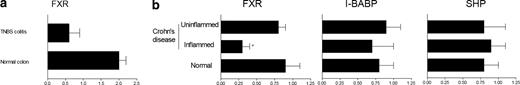 FIGURE 3. Colonic expression of FXR is reduced by inflammation. a, qRT-PCR analysis of FXR expression in whole colon homogenate of naive mice and mice administered TNBS; n = 5. ∗, p < 0.05. b, qRT-PCR of FXR, I-BABP, and SHP mRNA expression in inflamed and noninflamed mucosa of colons form patients affected by Crohn’s disease (n = 7) and control subjects (n = 7). ∗, p < 0.05 (ANOVA followed by Bonferroni) vs noninflamed mucosa and control subjects. In both panels, the relative expression of FXR vs GAPDH is shown.