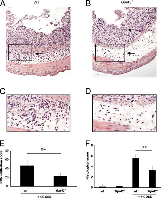 FIGURE 2. Gpr43−/− mice display less severe colonic inflammation. Histologies of WT and Gpr43−/− colons on day 6 of DSS treatment at a magnification of ×200 (A and B) and ×600 (C and D). PMN infiltrating assay was obtained by counting PMN cellularity in four random mucosal and submucosal views of three different sections from the descendent colon (E). Histologic score was performed in a blinded fashion, as described in Materials and Methods (F). Data are mean ± SEM. ∗∗, p < 0.01 (n = 10 per group).