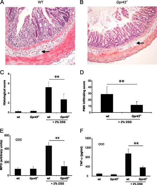 FIGURE 5. Gpr43−/− mice exhibit less severe colonic inflammation. Histological assessment of colon sections obtained of the descendent colon of WT and Gpr43−/− mice on day 30 (×200 magnification; A and B). Black arrows indicate different amounts of PMNs in the submucosa. Histologic score was performed in a blinded fashion, as described in Materials and Methods (C). PMN infiltrating assay was obtained by counting PMN cellularity in four random mucosal and submucosal views of three different sections from the descendent colon (D). Activity of MPO was measured in colon tissue homogenates (E). TNF-α levels were quantified after 24-h incubation time in the supernatant of COC isolated of 10 WT and 10 Gpr43−/− mice (F). Data are mean ± SEM. ∗∗, p < 0.01 (n = 10 per group).