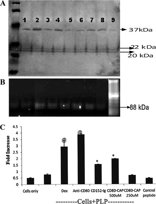 FIGURE 8. CD80-CAP treatment enhances GILZ expression in CD4+ T cells in EAE. CD4+ LNC from B10.PL mice induced EAE and isolated 10 days postimmunization were restimulated in vitro with MBP NAc1–11 (40 μg/ml) in the presence of dexamethasone (1 or 5 mg/ml) as positive control/anti-mouse CD80 mAb/CD80-CAP/control peptide as indicated for 48 h. A, GILZ expression was assessed by immunoblot analysis for cells only (lane 1), cells plus Ag (lane 2), cells plus Ag plus CD80-CAP (500 μM) (lane 3), cells plus Ag plus CD80-CAP (250 μM) (lane 4), cells plus PLP plus control peptide (500 μM) (lane 5), cells plus Ag plus dexamethasone (1 mg/ml) (lane 6), cells plus Ag plus dexamethasone (5 mg/ml) (lane 7), cells plus Ag plus anti-CD80 (lane 8), and cells plus Ag plus CD152 Ig (lane 9). Real-time PCR was performed to determine GILZ expression in the Ag-stimulated CD4+ LNC. B, Gel electrophoresis of the GILZ PCR product from different treatment group as shown for cells only (lane 1), cells plus Ag (lane 2), cells plus Ag plus dexamethasone (5 mg) (lane 3), cells plus Ag plus anti-CD80 (lane 4), cells plus Ag plus CD152 Ig (lane 5), cells plus Ag plus CD80-CAP (500 μM) (lane 6), cells plus Ag plus CD80-CAP (250 μM) (lane 7), and cells plus Ag plus control peptide (500 μM) (lane 9). Cells treated with dexamethasone represent positive control. C, Data analysis showed significantly up-regulated GILZ expression in the CD4+ T cells activated in the presence of dexamathasone/anti-CD80 mAb or the CD80-CAP at 500 μM concentration. ∗, p < 0.05 and @, p < 0.01 compared with cells plus Ag.