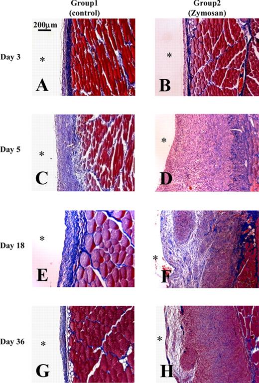 FIGURE 4. Fibrosis and cellular proliferations in peritoneum with and without zymosan in the peritoneal injury model. Frames A, C, E, and G show representative peritoneal pathology in group 1 rats (control) and frames B, D, F, and H show representative pathology in group 2 rats (zymosan). The sections were subjected to MT staining. Blue shows fibrous tissues and red shows cellular proliferating tissues. Original magnifications were ×100. Scale bar is in the upper left corner of frame A. ∗, External face of the peritoneum.