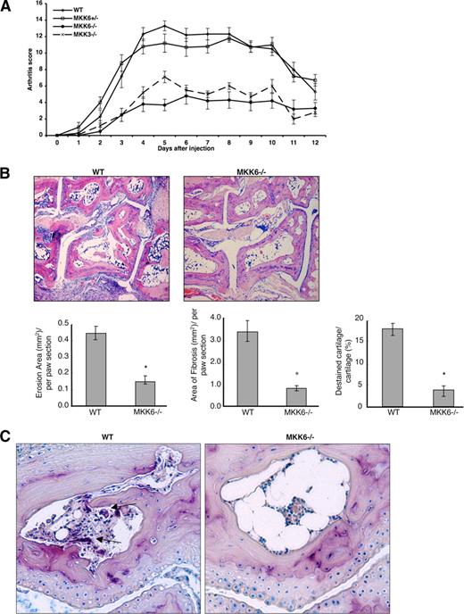 FIGURE 1. MKK6 deficiency attenuates arthritis, cartilage destruction, and bone erosion. A, WT (⋄), MKK6+/− (□), MKK3−/− (×), and MKK6−/− (•) mice (representative data from three separate experiments is shown; n = 6/group) were administered K/B×N serum i.p. on days 0 and 2, and arthritis scores were evaluated until day 12. (p < 0.001, two-way ANOVA). B, Histopathology of H&E-stained joints of rear right paws from WT and MKK6−/− mice on day 12. The joints of WT mice showed significantly greater fibrosis, cartilage degradation, and bone erosion than MKK6−/− mice (p ≤ 0.04). Representative examples of ankle histology demonstrate markedly less inflammation in the MKK6−/− mice compared with WT. C, Tartrate-resistant acid phosphatase (TRAP) staining showed that osteoclasts were undetectable in MKK6−/− mice compared with WT mice. *, p < 0.05.