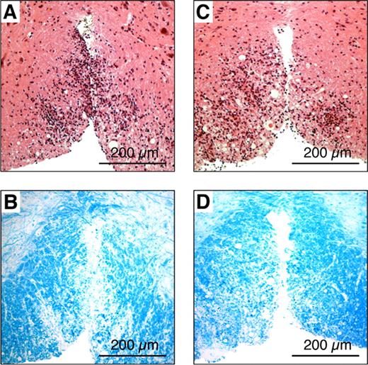 FIGURE 2. Histopathological assessment of the spinal cord of EAE mice. Spinal cords from EAE mice (n = 5/group) were removed on day 17 postimmunization as described in Material and Methods. The spinal cord sections from sham- (A and B) and ghrelin-treated (C and D) mice were stained in with H & E in the upper panels or Luxol fast blue in the lower ones. Representative sections are shown.
