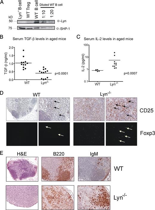 FIGURE 6. Lyn is not expressed in Tregs, TGF-β and IL-2 levels are altered in Lyn−/− mice, and Tregs are randomly distributed in Lyn−/− lymph node. A, CD4+CD25+CD45RBlow Tregs were FACS sorted from WT lymph node, and WT and Lyn−/− B cells were purified from spleen by MACS separation. Lysate prepared from the purified Treg sample (8 μg) was run adjacent to a Lyn−/− B cell lysate as a negative control for Lyn expression, and with lysates from WT B cells (8 μg and 1/10 and 1/20 dilutions) as positive controls for Lyn expression. The blot was probed with anti-Lyn to determine Lyn expression, followed by anti-SHIP-1 as a protein loading control. B, Active TGF-β levels in the serum of aged WT and Lyn−/− mice. C, Serum IL-2 levels in aged WT and Lyn−/− mice; p = 0.0007 by Mann-Whitney U test. D, Immunohistochemical and immunofluorescent staining of lymph nodes from aged WT and Lyn−/− mice with Abs to CD25 and Foxp3, respectively. A lower power view (magnification, ×4) and a higher power view (magnification, ×10) are shown for each stain. E, Histology and immunohistochemistry of sections of lymph node from aged WT and Lyn−/− mice. Staining was performed with H&E for morphology, Abs to B220 to detect B cells, and anti-IgM to detect plasma cells. Note that the anti-IgM used under the conditions of Ag retrieval does not react well with conventional B cells.