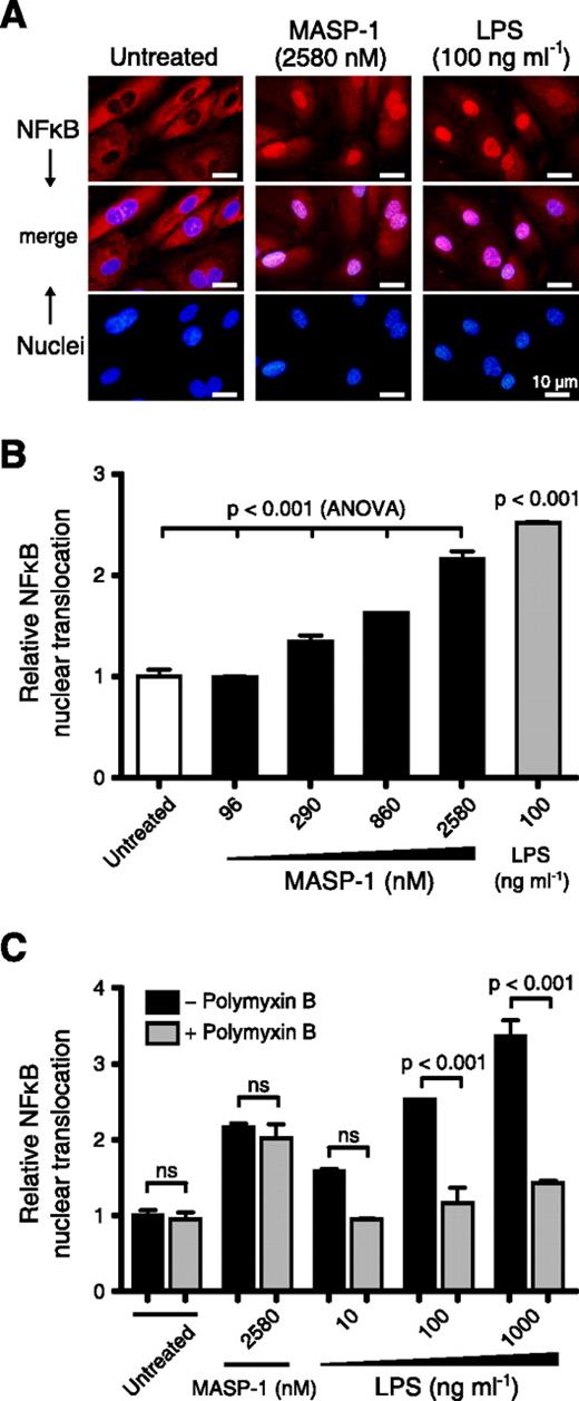 Complement Protease MASP1 Activates Human Endothelial Cells PAR4
