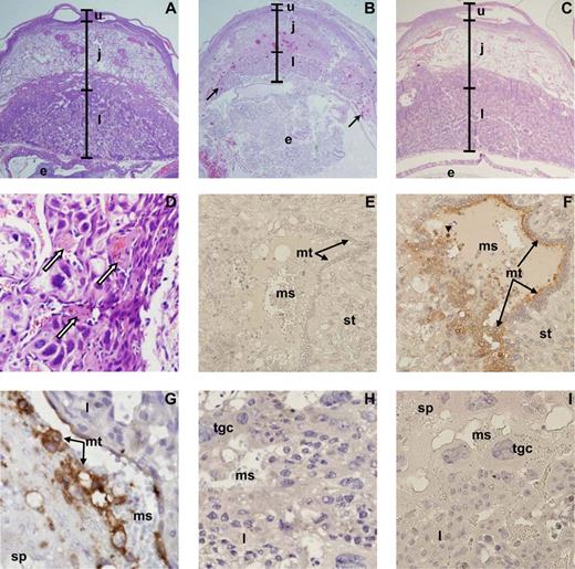 FIGURE 5. Histopathological and immunohistochemical analysis of the P. chabaudi AS-infected mouse placenta. A–D, H & E staining. E–I, Immunolocalization of TF by IHC. Intense brown staining with blue counterstaining with hematoxylin indicates specific immunolocalization of TF. A, Normal placenta at ED 11 shows three layers: the uterine wall and decidua (u), junctional zone (j; containing spongiotrophoblast), and labyrinth (l). The embryo is indicated by “e”. B, IP mouse placenta at ED 11. Reduced thickness of the labyrinth, extensive hemorrhage in placental tissue (arrows), and disruption of the embryo are evident. C, Anti-TNF Ab-treated mouse placenta at ED 12. Note the normal appearance of the placental architecture. D, Fibrin thrombi (arrows) in maternal blood sinusoids of the junctional zone in an ED 11 IP mouse. E, Section of placenta from the junctional zone/labyrinth interface in a mouse aborting at ED 9 stained with control IgG. F, Section from same location as shown in E, exhibiting strong expression of TF (brown color; arrows) on mononuclear cytotrophoblast (mt) surrounding a maternal blood sinusoid (ms). Syncytiotrophoblasts (st) are not stained. A maternal monocyte (arrowhead) in the maternal blood also stains intensely for TF. G, Intense TF staining in mononuclear cytotrophoblast at ED 10 between the labyrinth and the junctional zone, with spongiotrophoblast (sp). H, Placenta section from the labyrinth/junctional zone interface from an ED 12 UP mouse treated with TNF-neutralizing Ab stained with anti-TF Abs. Trophoblast giant cells (tgc) and other cell types do not express TF. I, Minimal placental TF-specific staining at the labyrinth/junctional zone interface in an ED 12 IP mouse treated with TNF-neutralizing Ab. Actual size represented by image: A–C, 3330 μm; D, 250 μm; E and F, 247 μm; G, 116 μm; H and I, 200 μm.