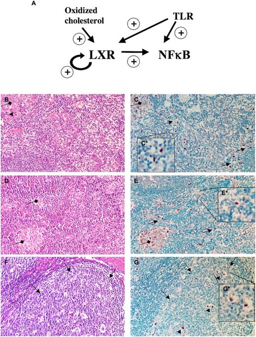 FIGURE 6. LXR integrates into TLR–NF-κB signaling and is present in DCs. A, A network in which lipid activated LXR integrates into the TLR–NF-κB signaling by enchancing NF-κB response. TLR activators increase–LXR response induced by activators such as oxidized cholesterols. B and C, Draining bronchopulmonary lymph node from a lung tissue of early active tuberculosis, with acid fast positivity for bacteria (not shown). B, H&E stained section. Diamond arrow points to the edge of an early granuloma. Arrowhead indicates a Langhans type of giant macrophage. C, LXRα immunostained consecutive section from the identical microscopic field shown in B. Note the LXRα nuclear positivity of sinusoidal DCs/histiocytes (arrows). Few cells with the same morphology are detectable in early granuloma epithelioid cells (diamond arrows). The inset in C demonstrates DCs with LXRα nuclear positivity (brown staining) that are digtally magnified. D and E, Mediastinal lymph node harboring sarcoidosis showing non-necrotising granulomas (diamond arrows). D, H&E-stained section. E, The corresponding section from the same microscopic field that is immunostained with LXRα Ab. Note the LXRα nuclear positivities in DCs and histiocytes in association with the sinus system (arrows, brown staining) and the granuloma cells (diamond arrows). The inset in E shows DCs with LXRα nuclear positivity that are digtally magnified. F and G, Tumor-associated reactive lymph node. F, H&E. G, LXRα-immunostained corresponding section of the lymph node from the vicinity of a seminoma tumor (the tumor is not shown). Note the positive nuclear LXRα staining of DCs (arrowheads, brown staining) located in the germinal center (arrows). The inset in G shows DCs with LXRα nuclear positivity that are digtally magnified. Note that cells in the insets in C, E, and G are commonly detected with S100 protein also (not shown). Negative controls for C, E, and G showed no tissue reactivities confirming the immunostaining specificities for LXRα (not shown, see Materials and Methods). B–G, Original magnification ×20.