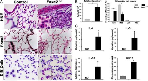 FIGURE 1. Deletion of Foxa2 in respiratory epithelium caused pulmonary eosinophilic inflammation and goblet cell differentiation. The Foxa2Δ/Δ mice spontaneously developed airway inflammation, eosinophilic infiltration, and goblet cell metaplasia at PN15. Loss of Foxa2 expression was confirmed by immunohistochemical staining. Increased eosinophils in BALF were revealed by Diff-Quik staining (A, original magnification ×400). Numbers of total cells, eosinophils, macrophages, lymphocytes, and neutrophils in BALF were assayed. Increased numbers of total cells and eosinophils were found in BALF from Foxa2Δ/Δ mice (B). Expression of Th2 cytokines (IL-4, IL-5, and IL-13) and chemokine Ccl17 (Tarc) was increased in BALF of Foxa2Δ/Δ mice as determined by ELISA (C). Inserts in A are the higher magnification of the regions indicated by arrows. The graphs represent means ± SE; n = 6 for each genotype. Scale bar, 50 μm. *p < 0.05, versus controls using Student t test (two-tailed, unpaired). Eos, eosinophil; Lym, lymphocyte; Mac, macrophage; Neu, neutrophil.