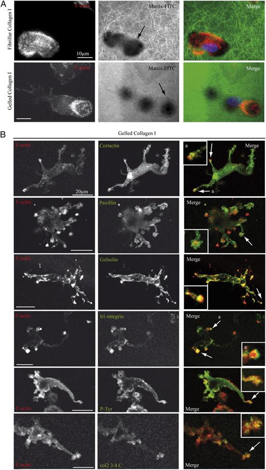 FIGURE 6. A, Human MDMs adherent on 2D fibrillar and gelled collagen form podosomes and degrade the matrix. Cells were loaded on glass coverslips coated with a thin layer of FITC-labeled fibrillar or gelled collagen I. After 16 h of adhesion, cells were fixed and stained for F-actin with Texas Red phalloidin. Note that cells are flattened, form podosomes (F-actin–enriched dots), and degrade the matrix underneath the cells on the two matrices (arrows). The holes in the FITC matrix were frequently below F-actin–rich podosomes. Holes that did not coincide with F-actin could correspond to podosomes that had turned over during the time of the experiment. Note that podosomes often accumulate at the leading edge of the migrating cells. Bars: 10 μm. B, Human MDMs in 3D form F-actin–, cortactin-, paxillin-, gelsolin, β1-integrin ,and P-tyr–enriched structures with collagenolytic activity at the tip of pseudopodia when migrating via the mesenchymal mode. After migration in gelled collagen I matrices in Transwell inserts for 72 h, samples were fixed, permeabilized, and stained with anticortactin, antipaxillin, antigelsolin, anti–β1-integrin, anti–P-tyr, or Col23/4Cshort Abs (to detect positive collagenolytic activity) and Texas Red phalloidin. Membrane protrusions enriched in F-actin, cortactin, paxillin, gelsolin, β1-integrin, and P-tyr and positive for collagenolytic activity are shown (B, arrows and inset). Samples were monitored by confocal microscopy (Leica SP2). Images show projections of 2–10 z-sections of 0.4 μm in depth. Bars: 20 μm. Insets in B are zoomed four times.