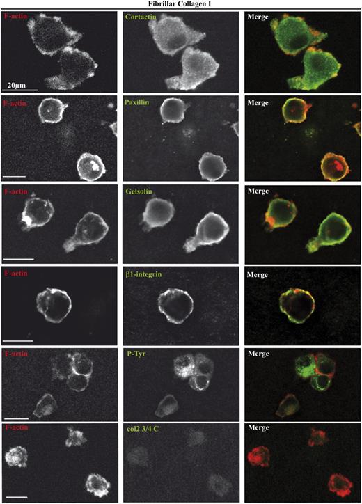 FIGURE 7. Human MDMs migrating via the amoeboid mode do not form pseudopodia enriched in F-actin, cortactin, paxillin, gelsolin, β1-integrin, and P-tyr and do not have a collagenolytic activity. After migration in fibrillar collagen I matrices in Transwell inserts for 48–72 h, samples were fixed, permeabilized, and stained with indicated primary Abs as described in Fig. 6 and Texas Red phalloidin (original magnification ×100). Bars: 20 μm.