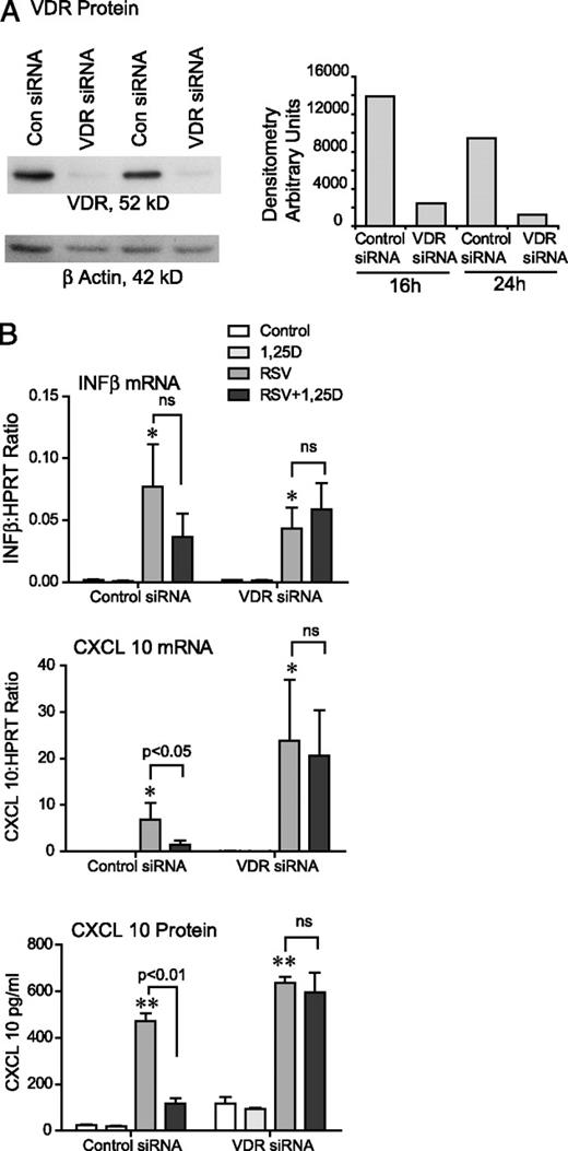 FIGURE 5. Silencing the VDR abolishes the effects of vitamin D on RSV-induced IFN-β, chemokines, and ISGs. A, hTBE cells were transfected with control siRNA or VDR siRNA for 16 or 24 h, and VDR protein was evaluated by Western blot analysis. The VDR siRNA successfully knocked down the VDR. B, hTBE cells were transfected with control siRNA or VDR siRNA for 24 h, pretreated with 1,25D for 16–18 h, and then infected with RSV (MOI 1–2) for 24 h. IFN-β, CXCL10, MxA, and ISG15 mRNA were evaluated by QRT-PCR, CXCL10 protein was evaluated by ELISA, and ISG15 protein was evaluated by Western blot analysis. Vitamin D reduced the expression of IFN-β, CXCL10, MxA, and ISG15 in cells transfected with control siRNA but had no effects in cells transfected with VDR siRNA. ANOVA with Bonferroni’s test for multiple comparisons. *p < 0.05; **p < 0.01 when compared with control.