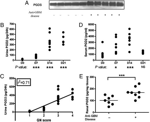 FIGURE 3. Urine PGDS/PGD2 is elevated in anti-GBM disease. PGDS/PGD2 levels in urine (A and B), serum (D), and kidneys (E) of anti-GBM–challenged B6 mice are displayed. PGDS was assayed by Western blot in A, and PGD2 was assayed using colorimetric assays in B–E. Correlation between urine PGD2 and the corresponding GN score in all anti-GBM–challenged mice is plotted in C. Each dot represents data from an individual mouse. Horizontal bars denote group means. Day 0 (i.e., no anti-GBM challenge) data were compared with postchallenge values, using the Student t test. *p < 0.05; ***p < 0.001.