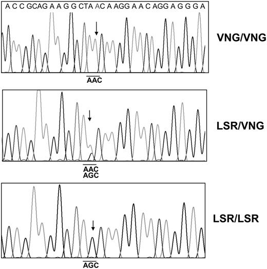 FIGURE 1. Nucleotide sequencing analysis of polymorphic PECAM-1 from three different HUVECs. mRNA extracted from HUVECs were reverse transcribed into cDNA and amplified with PECAM-1–specific primers and sequenced. Arrows indicate the position of SNP of PECAM-1 encoding asparagine/serine dimorphism (underline) at position 536 located in IgD6.