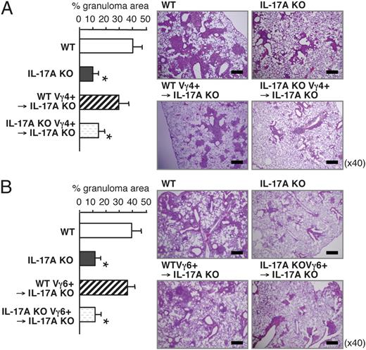 FIGURE 4. Restored pulmonary granulomas in the BCG-infected IL-17A KO mice by adoptive transfer of IL-17A–producing TCR γδ T cells. TCR Vγ4+ (A) or Vγ6+ (B) γδ T cells were isolated from the PIF cells of BCG-infected mice or the PEC cells of E. coli-infected mice, respectively. These cells were injected i.v. into IL-17A KO mice 1 d preinfection. Lung sections were obtained on day 28 of the infection and stained with H&E (right panels, original magnification ×40), and the percentage of granulomatous area was calculated (left panels). The percentage of granulomatous area for 10–15 sections was determined; the mean and SD are shown. Representative results from three separate experiments are shown in each panel. *p < 0.00001 in comparison with WT mice.
