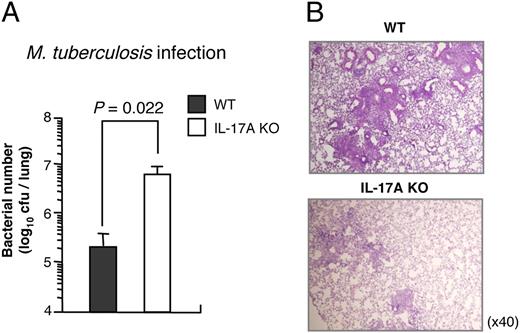 FIGURE 6. Bacterial growth and granuloma formation after i.t. M. tuberculosis infection. A, The numbers of bacteria recovered from the lungs were determined on day 28 of M. tuberculosis infection. B, The formalin-fixed lung sections were preparted on day 28 of the infection and stained with H&E. Representative results from three separate experiments are shown in each panel. Original magnification ×40.