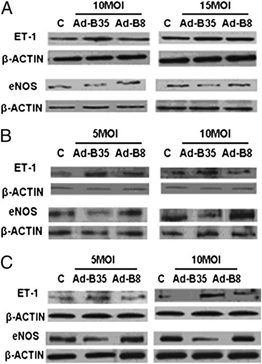 FIGURE 2. Expression of ET-1 and eNOS protein levels in ECV304 (A), HUVEC (B), and HDMEC (C) cells transduced with HLA-B35 or HLA-B8 Ads. ECs were transduced with 10 and 15 MOI (ECV304) or 5 and 10 MOI (HUVECs and HDMECs) of Ad-B35/GFP or Ad-B8/GFP for 48 h; 20 μg of total cellular proteins were separated via 15% SDS-PAGE for ET-1 (7.5% for eNOS) and transferred to a nitrocellulose membrane. The blots were probed overnight with primary Abs at 4°C. As a control for equal protein loading, membranes were stripped and reprobed for β-actin using a mAb to β-actin. Representative blots of at least three experiments are shown.