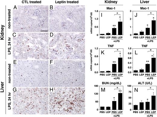 FIGURE 4. Effects of exogenous leptin on macrophage infiltration, organ function, and vascular leakage during endotoxemia. LEP- and CTL-treated mice were subjected to endotoxemia. Blood samples were taken at 24 h and assayed for serum ALT (N) and BUN (M). The liver and kidney were harvested at 24 h and stained for Mac-1 (Mac-1, red; Hematoxylin, blue) (kidney, A–D; liver, E–H) and used for quantitative real-time PCR analyses (mRNA copy number per 106 copies of 18S) of Mac-1 and TNF (I–L). All data were expressed as mean ± S.D. of three independent experiments. +p < 0.1; **p < 0.001; ***p < 0.0001 compared with PBS-treated controls. Scale bar in A (50 μm) also applies to B–H (original magnification ×630).
