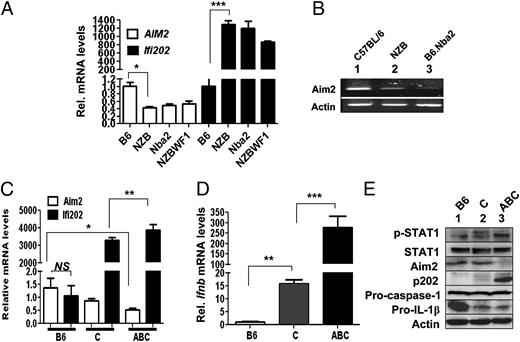 FIGURE 4. Lupus-susceptible mice express reduced levels of the Aim2 protein. A, Total RNA prepared from splenocytes isolated from C57BL/6 (B6), NZB, B6.Nba2 (Nba2), or (NZB × NZW)F1 (NZBWF1) female mice (age ∼9 wk) was analyzed by quantitative TaqMan real-time PCR using an assay either specific to the Aim2 or the Ifi202 genes. The ratio of the test gene to β2-microglobulin mRNA was calculated in units (one unit being the ratio of the test gene to β2-microglobulin mRNA). The relative levels of Aim2 or Ifi202 mRNA in the B6 female mice are indicated as 1. Results are mean values of triplicate experiments, and error bars represent SD. *p < 0.05; ***p < 0.001. B, Total RNA isolated in A was also analyzed by semiquantitative PCR using a pair of primers specific to the indicated gene. C, Total RNA prepared from splenocytes isolated from B6, B6.Nba2-C (C), or B6.Nba2-ABC (ABC) female mice (age ∼4 mo) was analyzed by quantitative TaqMan real-time PCR using assay specific to either Aim2 or Ifi202. The ratio of the test gene to β2-microglobulin mRNA was calculated in units (one unit being the ratio of the test gene to β2-microglobulin mRNA in splenocytes). The relative levels of Aim2 or Ifi202 mRNA are indicated. Results are mean values of triplicate experiments, and error bars represent SD. NS, not significant; *p < 0.05; **p < 0.01. D, Total RNA as described in C was analyzed by quantitative TaqMan real-time PCR using assay specific to the Ifnb gene. The ratio of Ifnb mRNA to β2-microglobulin mRNA was calculated in units (one unit being the ratio of the Ifnb to β2-microglobulin mRNA in splenocytes). The relative levels of Ifnb mRNA in the B6 female mice are indicated as 1. Results are mean values of triplicate experiments, and error bars represent SD. **p < 0.01; ***p < 0.001. E, Total cell extracts prepared from splenocytes isolated from B6, B6.Nba2-C (C), or B6.Nba2-ABC (ABC) female mice (age ∼4 mo) were analyzed by immunoblotting using Abs specific to the indicated proteins.
