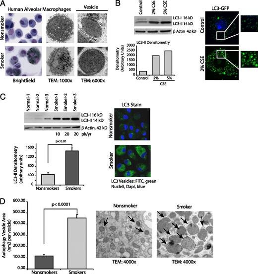 FIGURE 1. Cigarette smoke exposure in vitro and in vivo causes an increase in the number of autophagosomes. A, Alveolar macrophages were obtained from nonsmokers and smokers. Shown are representative TEM and Wright-Giemsa stains. The higher-magnification TEM image shows the presence of double-walled vesicles in smokers’ macrophages compared with a lack of double-walled vesicles in nonsmokers’ cells. Greater than 70% of vesicles in smokers’ cells had double membranes characteristic of autophagosomes. B, Alveolar macrophages from nonsmokers were exposed to 2 or 5% CSE for 5 h. Whole-cell lysates were obtained, and Western blot analyses for LC3-II were performed. Equal loading is demonstrated by probing the same blot for β-actin. The image is representative of four separate experiments. On the right is a confocal image of human alveolar macrophages transfected with LC3-GFP. After overnight incubation, some of the cells were exposed to 2% CSE for 5 h (original magnification ×630). Confocal analysis was performed to identify GFP-positive vesicles. C, Alveolar macrophages from three nonsmokers and three smokers were analyzed for LC3-II by Western blot analyses of whole-cell proteins. Below is a graph of densitometry results. Significance was determined using a nonpaired Student t test. On the right is a representative image of fixed alveolar macrophages from a nonsmoker and from a smoker stained for LC3b (original magnification ×630). D, Alveolar macrophages from nonsmokers and smokers were fixed shortly after isolation. TEM samples were prepared, and images were obtained. Autophagosome size was determined by analyzing the area (with ImageJ software) of double-walled vesicles in cells with slices obtained through the middle of the cell (determined by the nucleus). Measurements were obtained from three nonsmokers and three smokers (12 vesicles in each cell, four cells from each person), and the area of the vesicle was obtained by drawing circles around vesicles and performing ImageJ analyses. Significance was determined using a nonpaired Student t test.