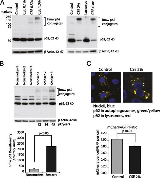 FIGURE 3. Cigarette smoke blocks delivery of the ubiquitin chaperone protein p62 to the lysosome. A, Nonsmokers’ alveolar macrophages were exposed to CSE at varying concentrations (0.1–1.0%) for 5 h. Whole-cell lysates were obtained, and Western blot analyses were performed for p62 protein. In the right panel, nonsmokers’ alveolar macrophages were exposed to lactacystin (10 μM) with and without 2% CSE for 5 h. B, Alveolar macrophages from three nonsmokers and three smokers were analyzed for hmw p62 aggregates by Western blot analyses of whole-cell proteins. Densitometry reflects the p62-positive bands between 100 and 250 kDa. Significance was determined using a nonpaired Student t test. C, HeLa cells were transfected with mCherry-GFP-p62. After an overnight incubation, cells were exposed to 2% CSE for 5 h. Confocal analysis was performed to identify yellow (green and red colocalization) vesicles versus red vesicles. Twelve individual cells from each group were analyzed for red pixels versus green pixels (20 confocal slices per cell) (original magnification ×630). Quantification is shown in the accompanying graph. Significance was determined using a nonpaired Student t test.