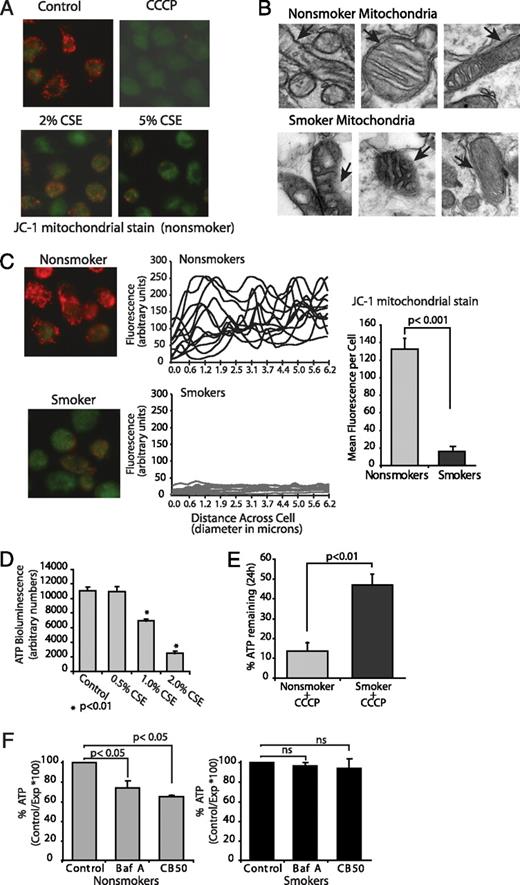 FIGURE 6. Cigarette smoke exposure results in the loss of mitochondrial electron transport chain function and accumulation of defective mitochondria. A, Human alveolar macrophages were cultured (1 × 106 cells per milliliter in two-chamber microscope slides) with and without 2–5% CSE or the uncoupler (CCCP). At the end of the incubation period, the mitochondrial stain JC-1 was added as described in the Materials and Methods. Red/orange stain denotes intact mitochondria with no disruption of membrane potential. Green staining denotes loss of mitΔΨ (original magnification ×400). B, TEM was performed on smokers’ and nonsmokers’ macrophages. Shown are mitochondria demonstrating damaged mitochondria in the smokers’ cells. Arrows in images point to intact (nonsmoker) and damaged (smoker) mitochondrial membranes (original magnification ×4000). C, Nonsmokers’ and smokers’ macrophages were allowed to adhere to two-chamber slides and stained with JC-1 (original magnification ×400). Quantification was performed as described in the Materials and Methods, and individual cell levels of red fluorescence from two separate experiments are shown in the line graphs and as a composite in the bar graph. D, Normal alveolar macrophages were cultured (96-well plate) with varying concentrations of CSE (0.5–2.0%). ATP levels were measured using a chemiluminescence assay system. Data are presented as arbitrary luminescent units and are a composite of three experiments. Significance was determined using a nonpaired Student t test. E, Nonsmokers’ and smokers’ alveolar macrophages were exposed the uncoupler CCCP for 24 h. ATP levels with and without the uncoupler were obtained, and the percentage of remaining ATP was calculated. Data are a composite of three smokers and three nonsmokers. Significance was determined using s nonpaired Student t test. F, Nonsmokers’ alveolar macrophages were exposed to the specific inhibitor of vacuolar-type H+-ATPase bafilomycin A (100 nM) or 50-nm carbon-black nanoparticles for 5 h. ATP levels were measured using a chemiluminescence assay system. Data are presented as arbitrary luminescent units and are a composite of three experiments. Significance was determined using a nonpaired Student t test.