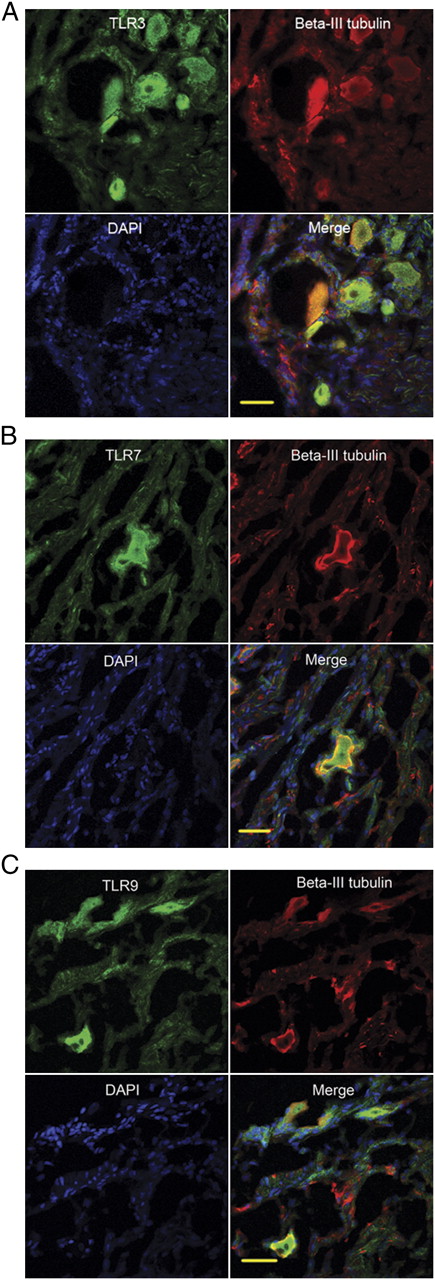 FIGURE 3. Human DRG sections express TLR3, TLR7, and TLR9. Confocal images of DRG cryostat sections. Samples were stained with TLR3 (A), TLR7 (B), and TLR9 (C) (green), neuron-specific β-III tubulin (red), and DAPI (blue). Shown are separate monochrome images of the green, red, and blue fluorescence channel and merged color images from all channels. Scale bars, 50 μm.