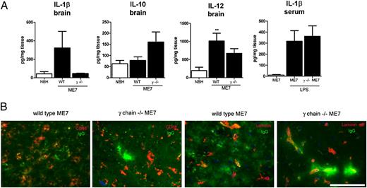 FIGURE 10. Cytokine expression levels and IgG deposition in the brains measured 24 h after systemic LPS challenge. ME7 prion disease was induced in WT C57/BL6 or γ-chain–deficient mice on a C57BL6 background. At 18 wk into the disease, animals received a systemic injection of LPS, and hippocampal/thalamic tissue was collected 24 h later. A, Cytokine expression levels. IL-1β, IL-10, and IL-12 (total) expression levels were measured in brain homogenates by multiplex ELISA as described in Materials and Methods. Data are presented as mean ± SEM with n = 3 (WT) or n = 5 (γ-chain–deficient) mice per group. **p < 0.01 (one-way ANOVA followed by Bonferroni posttest). B, IgG deposition. Levels of IgG were determined by immunohistochemistry in brains of ME7-infected WT or γ-chain–deficient mice 24 h after LPS challenge and costained with CD68 (microglia) or laminin (blood vessels) and DAPI (blue). A representative example of one independent experiment with n = 3 (WT) or n = 5 (γ-chain–deficient) mice per group is shown. Scale bar, 75 μm.