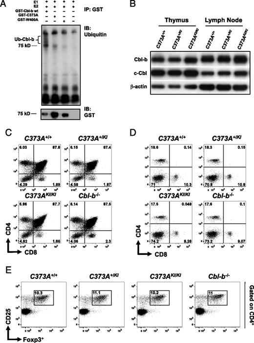 FIGURE 1. Cbl-b expression and T cell populations in Cbl-b E3 ligase-defective mice. A, In vitro ubiquitylation assay detecting auto-ubiquitylation of 75-kDa GST-tagged wild-type Cbl-b and RING finger mutants with a cysteine to alanine (C373A) or tryptophan to alanine (W400A) substitution. Both C373A and W400A point mutations abrogate Cbl-b E3 ligase activity (upper panel, anti-ubiquitin blot). As a loading control, an anti-GST blot is shown (bottom panel). B, Western blot for Cbl-b and c-Cbl protein expression in the thymus and lymph nodes of C373A+/+, C373A+/KI, and C373AKI/KI mice. β-Actin expression is shown as a loading control. Data are representative of a minimum of four different animals. C–E, T cell populations in naive 6- to 12-wk-old C373A+/+, C373A+/KI, C373AKI/KI, and Cbl-b−/− mice. Representative FACS blots for thymic (C) and splenic (D) CD4+/CD8+ T populations as well as splenic CD4+ CD25+ Foxp3+ T regulatory cells (E) are shown. Numbers indicate percentage of cells within a quadrant. Data are representative for a total of n = 5 (C373A+/+), n = 6 (C373A+/KI and C373AKI/KI), and n = 2 (Cbl-b−/−) mice.