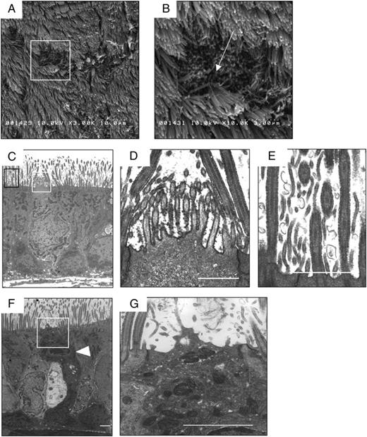 FIGURE 2. Electron microscopic analysis of respiratory M cells. A and B, SEM analysis shows that the M cells (B, arrow) in the nasal passage epithelium are distinguishable from adjacent respiratory epithelial cells by their relatively depressed and dark brush borders. An enlargement of the area in the rectangle in A is shown in B. As indicated in the Materials and Methods, the tissue specimen was incubated with HRP-conjugated UEA-1 before TEM analysis. C–E, TEM analysis of respiratory M cells reveals shorter and more irregular microvilli with definite UEA-1+ signals (D), unlike the cilia of neighboring respiratory epithelial cells (E). F and G, TEM analysis of NALT M cells. A readily apparent intraepithelial pocket with mononuclear cells (F, arrowhead) and short microvilli on the apical surfaces of NALT M cells are seen. The white squares in C and F indicate UEA-1+ respiratory and NALT M cells, respectively, and are magnified in D and G, respectively. The black rectangle in C indicates an adjacent respiratory epithelial cell and is magnified in E. C–G, Scale bars, 0.5 μm. Results are representative of four independent experiments.