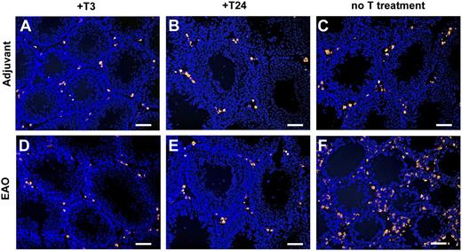 FIGURE 5. Immunofluorescence staining of testicular macrophages using combined Abs directed against ED1 and ED2 in frozen sections of animals supplemented with testosterone [(A) adjuvant+T3, (B) adjuvant+T24, (D) EAO+T3, (E) EAO+T24] and in control animals without testosterone substitution [(F) EAO and (C) adjuvant]. In contrast to EAO testis (F), no visible accumulation of macrophages is evident in EAO+T3 (D) and EAO+T24 (E) compared with that in adjuvant controls (A–C). Scale bars, 100 μm.