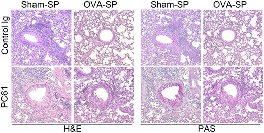 FIGURE 4. OVA-SP tolerance inhibits OVA-induced airway inflammation in a Treg-independent fashion. Mice were treated as indicated in Fig. 3A. Representative histology sections from mice sacrificed at day 35, stained with H&E or PAS as indicated, are shown at ×200 original magnification.