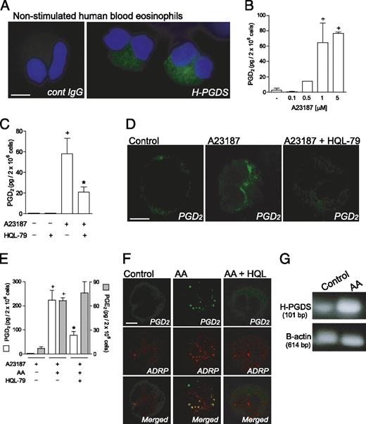 FIGURE 1. Human eosinophils are able to synthesize PGD2 in a H-PGDS–dependent manner. A, Epifluorescence images of cytoplasmic immunodetection of H-PGDS (green) in nonstimulated human eosinophils. Blue fluorescence shows eosinophil nuclei stained with DAPI. Eosinophils incubated with isotype irrelevant IgG are shown. B, PGD2 amounts secreted by human eosinophils stimulated for 15 min with A23187 (0.1–5 μM). C, Eosinophils were pretreated for 30 min with HQL-79 and then stimulated with 5 μM A23187. D, Confocal images of intracellular immunofluorescence for PGD2 in nonstimulated, A23187 (0.1 μM)-stimulated, and HQL-79–treated A23187-stimulated human eosinophils (as indicated). E, Production of PGD2 and PGE2 by human eosinophils stimulated for 1 h with AA (10 μM) and then challenged with A23187 (0.1 μM). Eosinophils were pretreated for 30 min with HQL-79. F, Confocal images of EicosaCell preparations display intracellular immunodetection of newly formed PGD2 (green) and of ADRP (red) in human eosinophils stimulated with AA (10 μM). Eosinophils were pretreated with HQL-79 for 30 min. Overlay images of identical fields are shown in the larger images. G, Constitutive levels of H-PGDS mRNA and its upregulation in human eosinophils that were stimulated for 1 h with AA (10 μM) were assessed by RT-PCR. Values are expressed as means ± SEM of at least three distinct donors. +p ≤ 0.05 compared with control, *p ≤ 0.05 compared with A23187- or AA-stimulated eosinophils. All the images are representative of three independent experiments with distinct donors. Scale bar, 5 μm.