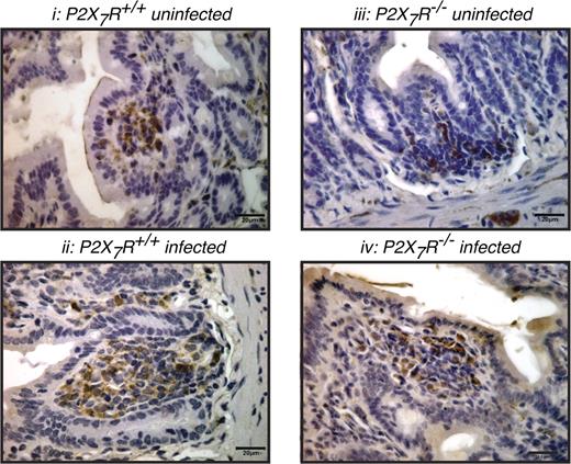 FIGURE 3. IL-1β expression is differentially altered in the jejunum of T. spiralis-infected WT and P2X7R−/− mice. Photomicrographs demonstrating anti–IL-1β immunostaining of jejunal segments from uninfected and T. spiralis-infected (8 d PI) WT and P2X7R−/− mice. Following T. spiralis infection, intracellular IL-1β levels are increased in the WT animals only. Scale bars, 20 μm.