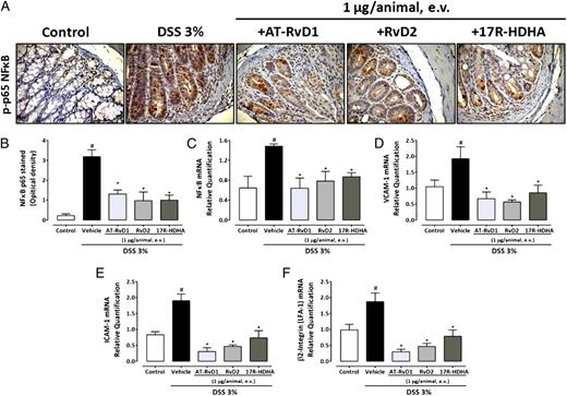 FIGURE 4. AT-RvD1, RvD2, and 17R-HDHA inhibit the NF-κB pathway and decrease expression of adhesion molecules in mouse colon with DSS-induced colitis. Following a 7-d AT-RvD1, RvD2, or 17R-HDHA treatment, colon samples were processed for immunohistochemistry analysis or mRNA expression. Systemic treatment with AT-RvD1, RvD2, or 17R-HDHA (1 μg/animal) significantly reduced phospho (p)-p65 (an NF-κB subunit) immunostaining, compared with the DSS-alone group (A, B). At the same dose, the lipid mediators suppressed NF-κB (C), VCAM-1 (D), ICAM-1 (E), and LFA-1 mRNA (F) expression in mouse colon with DSS-induced colitis. The mean intensity for p-p65 NF-κB staining was determined from image analysis and is represented as arbitrary units. Original magnification ×400. Real-time PCR assay was performed in duplicate, and GAPDH mRNA was used to normalize the relative amount of mRNA. Data are reported as means ± SEM of five to seven mice. #p < 0.05 versus the control group, *p < 0.05 versus the DSS-treated group.