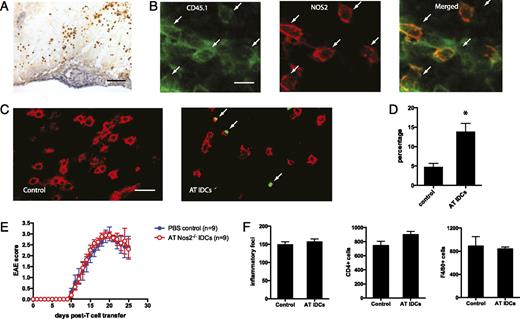FIGURE 12. Transfer of activated IDCs induces T cell apoptosis in the CNS. Activated IDCs were transferred on day 5 in the passive EAE model as described above, except that IDCs were derived from CD45.1 congenic mice. Spinal cord tissues were harvested on day 11 from three control mice and three IDC recipient mice. A, Tissue sections from IDC recipient mice were stained for CD45.1 by immunohistochemistry (brown). Scale bar, 20 μm. B, Double staining of CD45.1 (green) and NOS2 (red) in tissue sections from IDC recipient mice show that many CD45.1+ cells expressed NOS2 (pointed to by arrows). Scale bar, 10 μm. C, Tissue sections from control and IDC recipient mice were processed for TUNEL (green) and CD4 (red) staining. Arrows point to TUNEL-positive CD4+ T cells. Scale bar, 10 μm. D, Quantitation of the percentage of TUNEL-positive CD4+ T cells in spinal cords from control and IDC recipient mice. Data are representative of two independent experiments. E, IDCs derived from Nos2−/− mice were activated with IFN-γ/GM-CSF/LPS and transferred in the same model described in Fig. 11B. EAE disease was monitored. F, Spinal cord tissues were collected from control and Nos2−/− IDC recipients on day 20 and stained for H&E, CD4, and F4/80. Inflammatory foci and specific inflammatory cells were quantified from three mice per group. *p < 0.05.