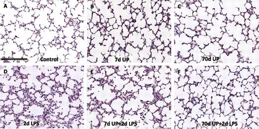 FIGURE 1. Lung histology after intraamniotic exposure to LPS, acute, and chronic IA exposure to U. parvum. Representative photomicrographs showing H&E staining of lung sections from the animals with intraamniotic exposures to controls (A), 7-d U. parvum (B), 70-d U. parvum (C), 2-d LPS (D), 7-d U. parvum + 2-d LPS (E), and 70-d U. parvum +2-d LPS (F). Note the similarity of histology in A, B, C, and F. D and E demonstrate inflammatory cells in the airways and lung interstitium. Scale bar, 100 μm.
