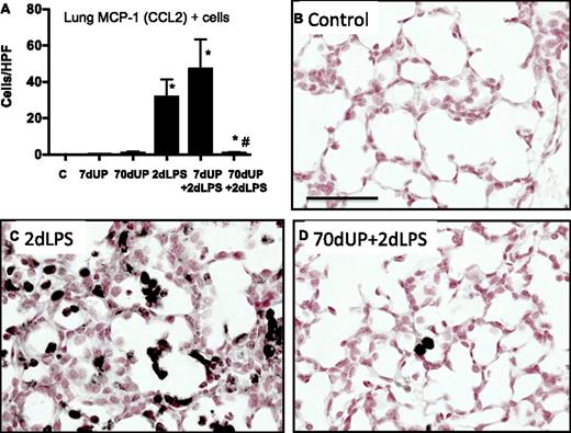 FIGURE 6. Chronic amniotic exposure to U. parvum decreased IA LPS-induced MCP-1 expression. A, Quantitation of MCP-1–positive cells per high-power field. Representative pictures from controls (B), 2-d LPS (C), and 70-d UP + 2-d LPS (D) Scale bar, 50 μm. *p < 0.05 versus control, #p < 0.05 versus 2-d LPS.