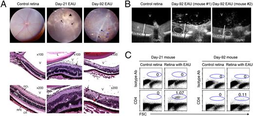 FIGURE 1. Chronic intraocular inflammation induces retinal degeneration and neovascularization. A, Fundus images were taken from normal or EAU mice using an otoendoscopic imaging system, and assessment of severity of the inflammatory disease was based on changes at the optic nerve disc and retinal vessels or tissues (top panels). Left-most panels, Control retina with well-circumscribed optic disc and normal retinal vessels; histology revealed intact retinal architecture (bottom panel). Middle panels, Fundus image of retina 21 d after EAU induction (day 21 EAU) showing severe inflammation with blurred optic disc margins and enlarged juxtapapillary area (black arrowhead), retinal vasculitis with moderate cuffing (black arrows), and yellow-whitish retinal and choroidal infiltrates (white arrows). Histological analysis reveals substantial numbers of inflammatory cells in the vitreous, photoreceptor cell damage (white asterisk), granuloma (white arrowhead), choroiditis (black arrowhead), and retinal edema (the thickened retina) (bottom panel). Right-most panels, 92 d after EAU induction (day 92 EAU), fundus image reveals severe vasculitis with cuffing (black arrows) with part of the vessel segment not visible. Retinal structural damage was observed, including evidence of atrophic retina (thinning) and sclerotic vessel (red arrow) with multiple whitish infiltrates (white arrow) and brownish chorioretinal scars (blue arrows). Histology revealed photoreceptor cell loss (red asterisk), retinal vasculitis (black arrows), retinal sclerotic vessel (white arrow), choroiditis (black arrowhead), and retinal degeneration (bottom panel). Sections were stained with H&E. B, Layered structure of the retina was visualized by spectral domain optical coherence tomography and used to follow the evolution of pathology induced by chronic uveitis. Change in the thickness of retina (white bar) or RPE-choroid layer (black bar) was used to quantify severity of the retinal degeneration. The oval highlights hypodense area indicative of retinal edema, and speckles in the vitreous represent clusters of residual inflammatory cells. C, Quantitative analysis of inflammatory cells in the day 21 or day 92 mouse retina. Numbers in each panel indicate percentage of CD4+ T cells, and the result is representative of three independent experiments. CH, choroid; GCL, ganglion cell layer; INL, inner nuclear layer; ONL, outer nuclear layer; OpN, optic nerve; R, retina; RPE, retinal pigment epithelial layer; RPE-CH, RPE-choroid; V, vitreous.