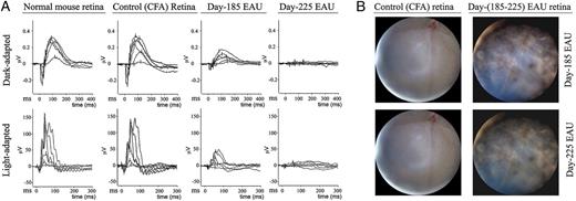 FIGURE 2. Prolonged intraocular inflammation in neuroretina caused vision loss and blindness. B10.A mice were immunized with CFA alone or IRBP/CFA emulsion, and ERG recordings were obtained and analyzed 185 or 225 d p.i. A, ERGs of control unimmunized mice or control mice immunized with CFA alone reveal the characteristic normal a, b, and cone waves. In contrast, light-induced response was barely elicited from retinas of IRBP-induced EAU mice. B, Immediately after ERG recordings, imaging of the fundus was performed as previously described.