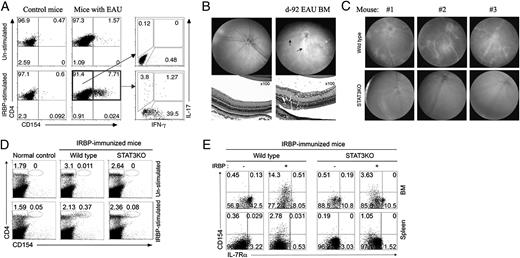 FIGURE 5. BM cells from day 92 EAU mice express IL-17 and IFN-γ and transferred EAU to naive mice through STAT3-dependent mechanisms. A, BM cells from control or day 92 EAU mice were stimulated with IRBP for 12 h and then assayed for intracellular cytokine expression. Numbers in quadrants indicate the percentage of CD154-expressing, IFN-γ−expressing, or IL-17–expressing CD4+ T cells. B, IRBP-stimulated BM cells from control or day 92 EAU mice were transferred (1 × 107 cells/mouse) into naive syngeneic C57BL/6 recipient mice. Ten days after adoptive cell transfer, funduscopy and histology revealed the development of retinal vasculitis (black arrows) and inflammatory infiltrates (white arrows). C, WT or CD4-STAT3KO mice were immunized with IRBP in CFA, and fundus images were taken on day 92 p.i. D, BM cells were restimulated with IRBP, and the percentage of IRBP-specific CD4+ T cells (CD154+) was quantified by flow cytometry. E, BM cells from day 92 p.i. mice were restimulated in vitro with IRBP, and IL-7Rα– and CD154-expressing CD4+ T cells were detected by FACS analysis.