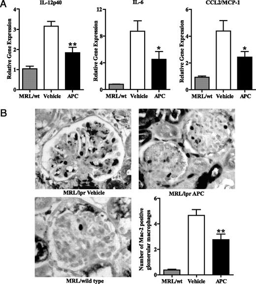 Activated Protein C Attenuates Systemic Lupus Erythematosus and Lupus