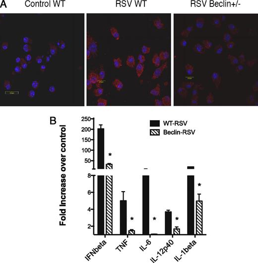 FIGURE 3. RSV infection of DC from Beclin+/− has altered autophagosome formation and an attenuated innate cytokine response. DC obtained from bone marrow of Beclin+/− and wild-type control B6 animals were infected with RSV and then subjected to confocal microscopy after staining for LC3 to identify autophagosomes (A). Scale bar, 20μm. Expression of innate cytokine expression was assessed by qPCR in the DC from wild-type and Beclin+/− mice after 24 h of infection (B). Data represent mean ± SE from two repeat experiments. *p < 0.05.