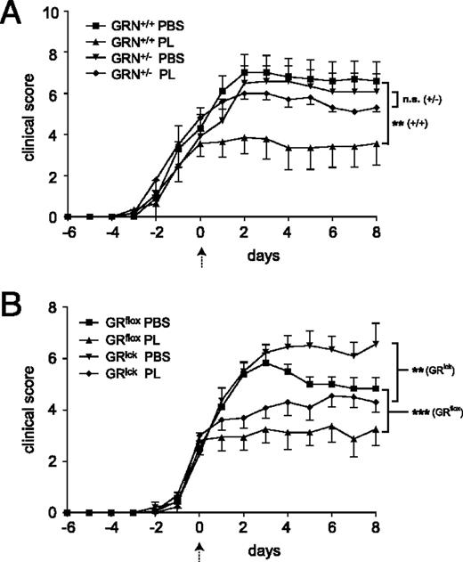 FIGURE 3. The therapeutic effect of liposome-encapsulated prednisolone depends on GR expression per se, but T cells are not their main target. A, Wild type GRN+/+ and mutant GRN+/− mice were therapeutically treated with 10 mg/kg PL or PBS as a control starting at an average disease score of 2–3 (marked by a dashed arrow and set as day 0); n = 5–7 (pool of two separate experiments). B, GRlck mice, which lack the GR specifically in T cells, and GRflox control mice were treated with 10 mg/kg PL or PBS as a control. n = 8–19 (pool of three separate experiments). All values are depicted as mean ± SEM. Statistical analysis was performed by comparing the disease courses between days 1 and 8 after the beginning of treatment.