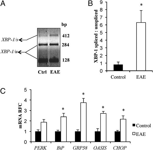 FIGURE 6. ER stress genes are induced during EAE. A, Lumbar spinal cords were isolated from EAE and control mice at peak disease severity. RNA was isolated from the lumbar spinal cord and a cDNA library was synthesized. RT-PCR using primers designed to amplify XBP-1 spliced and unspliced transcripts was performed. Amplicons were cut with PstI endonuclease. The XBP-1 unspliced transcript variant has a PstI restriction site and thus digests into two smaller fragments. The PstI restriction site is spliced out during XBP-1 splicing; therefore, the XBP-1 spliced transcript variant lacks a PstI restriction site and will not be cleaved during PstI treatment. The sizes of digested amplicons were measured on a 2% agarose gel using gel electrophoresis. This experiment was repeated three times. B, Band intensity ratio of XBP-1 spliced to XBP-1 unspliced was measured using ImageJ computer software. C, ER stress gene transcript levels in the spinal cords of EAE and control mice. Data are presented as mean ± SEM (*p < 0.05).