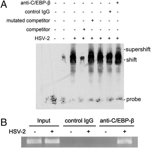 FIGURE 3. C/EBP-β binds to CXCL9 promoter induced by HSV-2. (A) ME-180 cells were infected with HSV-2 for 24 h. Nuclear extracts were incubated with either wild competitor, mutated competitor, anti–C/EBP-β Ab, or control IgG before the addition of biotin-labeled oligonucleotides. C/EBP-β–specific DNA-protein shift or supershift complexes are indicated. One representative experiment of three is shown. (B) Chromatin immunoprecipitation assay was performed using an Ab against C/EBP-β or a control Ab to pull down the fragment containing the C/EBP binding site in CXCL9 promoter prepared from ME-180 cells cultured alone or infected with HSV-2. Amplification of the input DNA is shown. One representative experiment of three is shown.