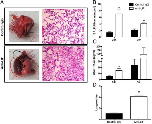 FIGURE 2. Effect of LIF neutralization on ALI. Lungs were collected from mice 24 h after i.t. inoculation of E. coli coinstilled with anti-LIF or control IgG. (A) Representative images are shown for intact freshly isolated lungs and H&E-stained lung sections (original magnification ×10). Red circles are used to denote infected left lung lobes. BALF concentrations of mouse albumin (B) and RAGE (C) as well as lung wet/dry weight ratios (D) were determined and expressed as means ± SEM. *p < 0.05 compared with mice treated with control IgG (n = 3–5).