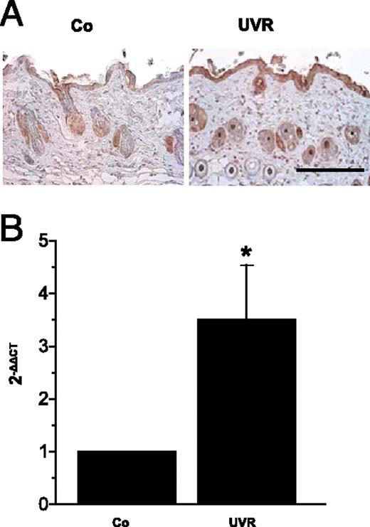 FIGURE 1. mBD-14 is induced by UVR. A, C57BL/6 mice were exposed to 1.5 kJ/m2 UVR or left unirradiated (Co). Skin samples taken 24 h later were stained using an anti–mBD-14 Ab. Data show one representative of three independent experiments. Scale bar, 200 μm. B, In parallel, total RNA was isolated from the skin samples and mRNA transcribed to cDNA. Quantitative real-time PCR was performed with specific primers against mBD-14 and evaluated in comparison with the 36B4 housekeeping gene. Bars show mean ± SD of five different experiments. *p < 0.05 versus Co.